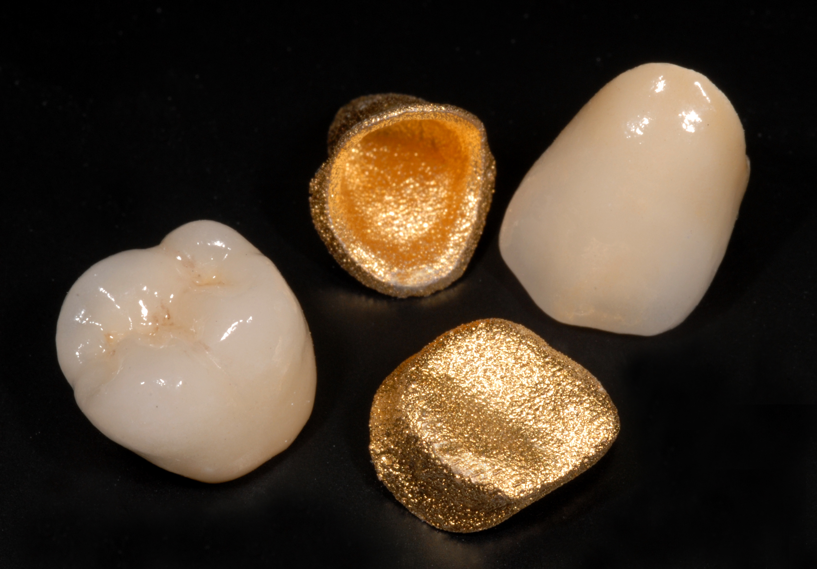 Mass Customization Comes to Dentistry Photo D